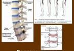 Болезни спины и их лечение