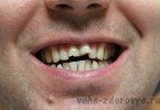 Лечение зубов стоматология